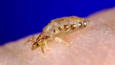 تفسير حلم القمل في الشعر للمتزوجة تفسير حلم القمل في الشعر للمتزوجة