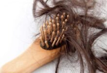 16 تفسير حلم سقوط الشعر للمرأة المتزوجة 16 تفسير حلم سقوط الشعر للمرأة المتزوجة