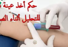 حكم التحليل أثناء الصيام