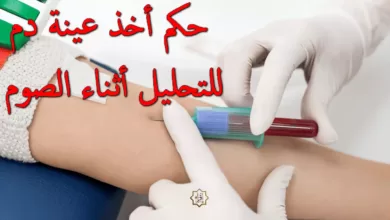 حكم التحليل أثناء الصيام