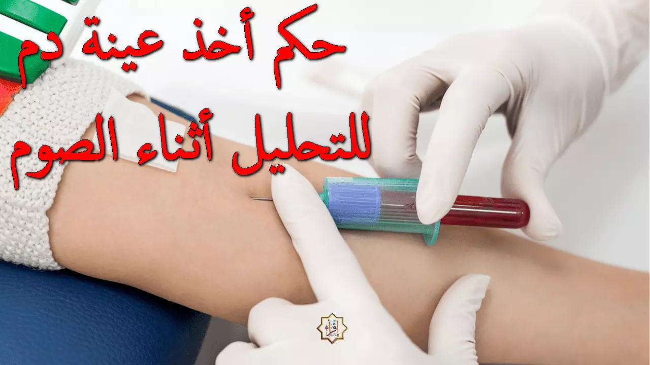 حكم التحليل أثناء الصيام حكم التحليل أثناء الصيام